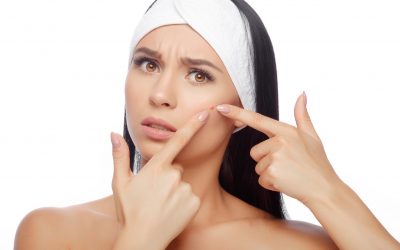 Você sofre com o excesso de acne?